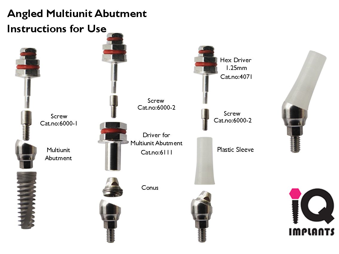 IQ Implants Multiunit Abutments