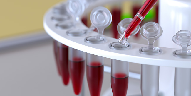 בדיקת PCR
