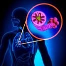 ברונכיטיס COPD
